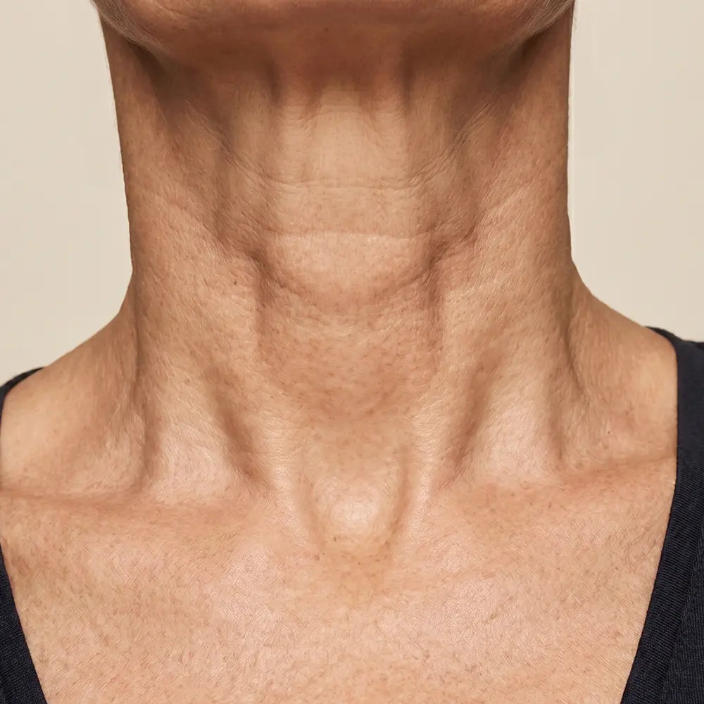 Cuello