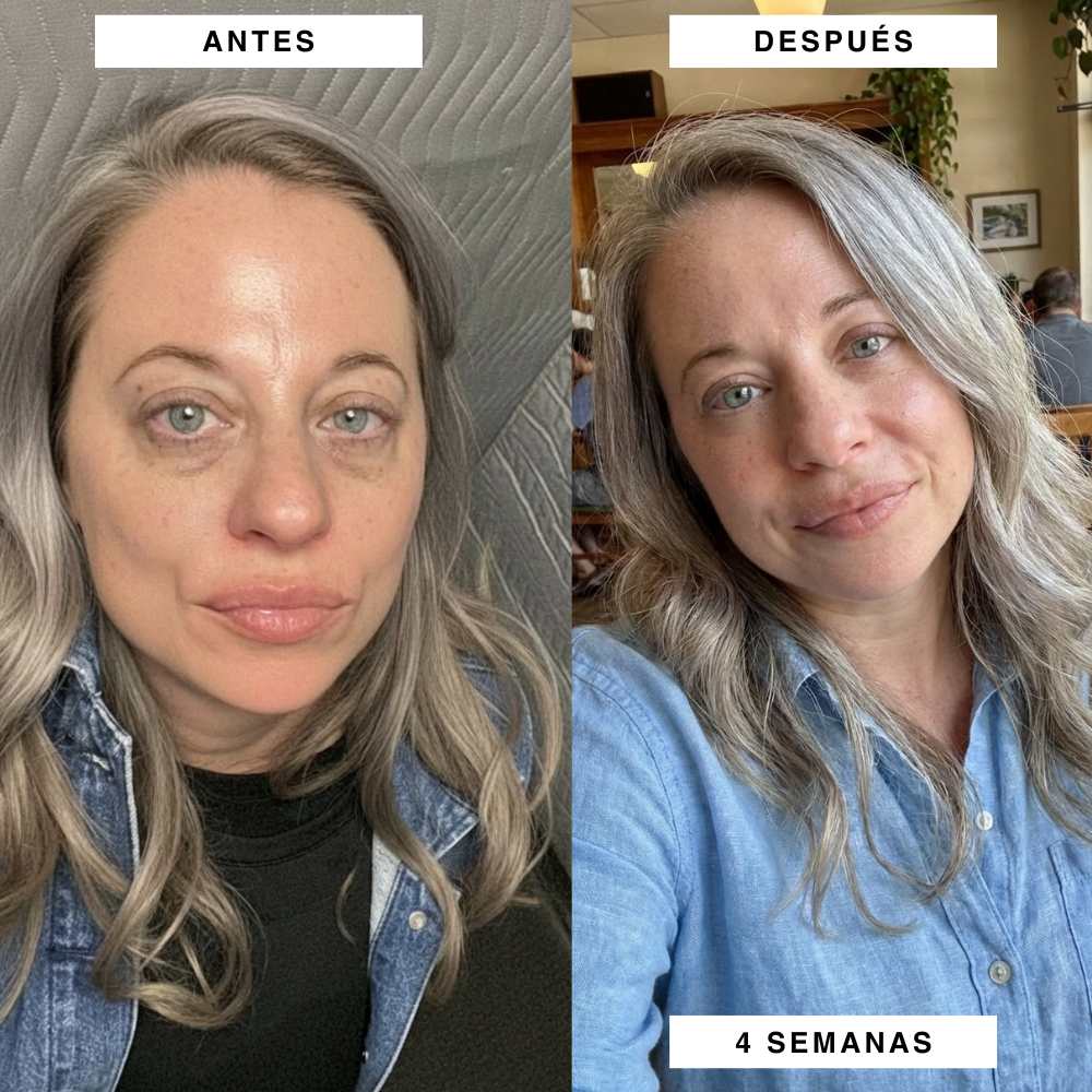 Parches PuraDerma™  - Reduce las ojeras