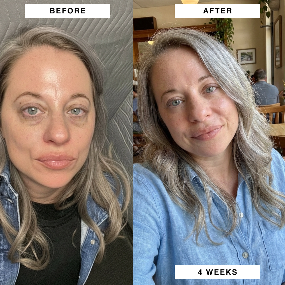 PuraDerma™ Microneedling Patches