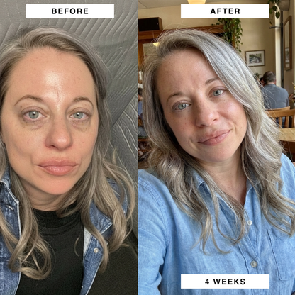 PuraDerma™ Microneedling Patches