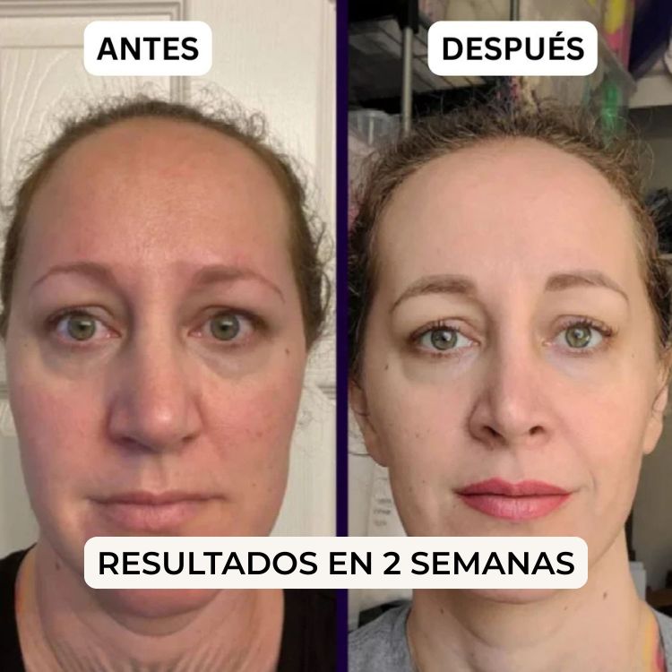 Parches PuraDerma™  - Reduce las ojeras