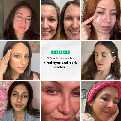 PuraDerma™ Microneedling Patches