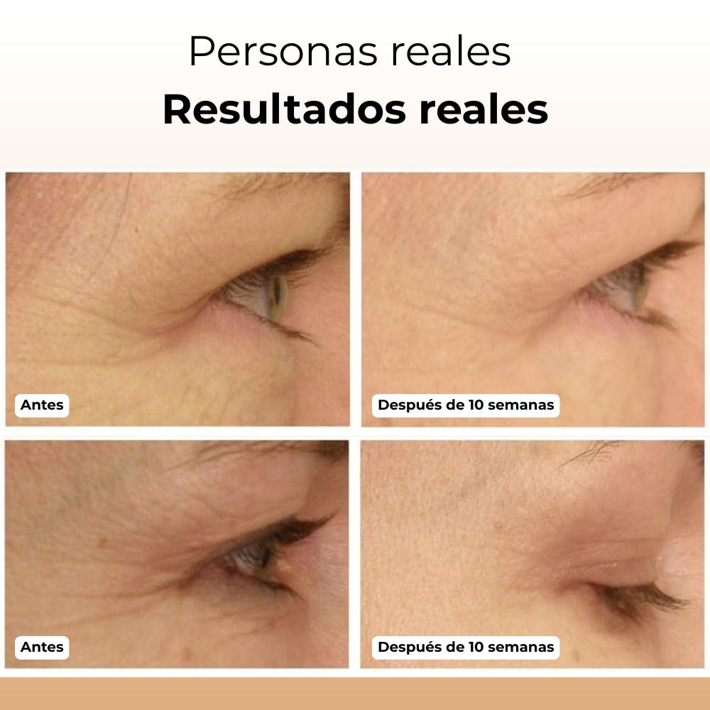 Soin des yeux PuraDerma™ Pro