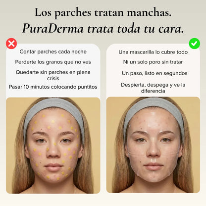 PuraDerma™ Mascarilla Hidrocoloide Anti-Imperfecciones Cobertura Total