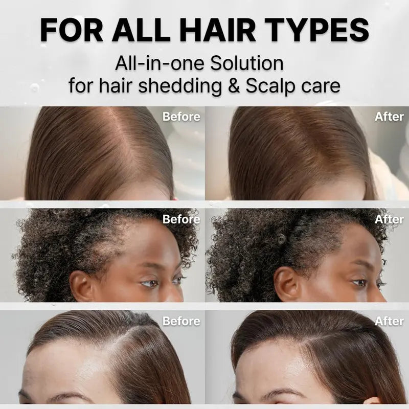 Suero para el Crecimiento del Cabello con Cepillo Incorporado
