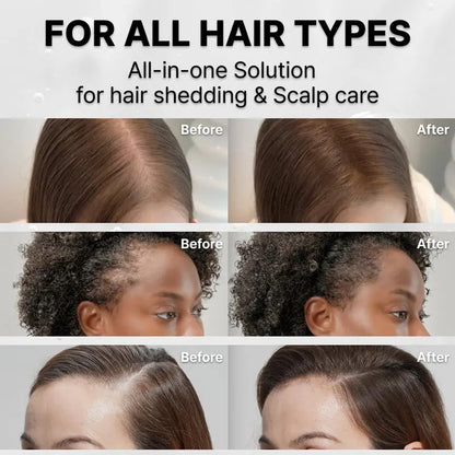 Suero para el Crecimiento del Cabello con Cepillo Incorporado