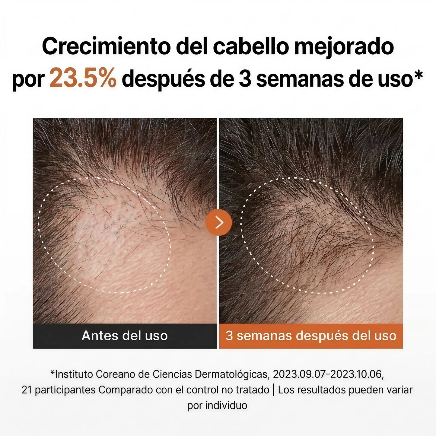 Suero para el Crecimiento del Cabello con Cepillo Incorporado
